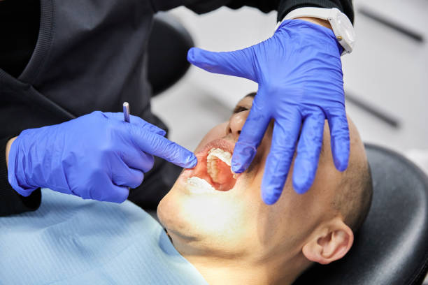 Best Dental Abscess Treatment in Roscoe, TX